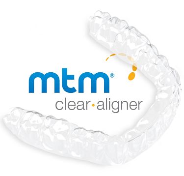 Minor Tooth Movement (MTM) Alignment